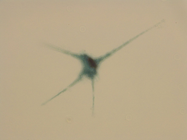Ceratium Slides - Ceratium 10 400X